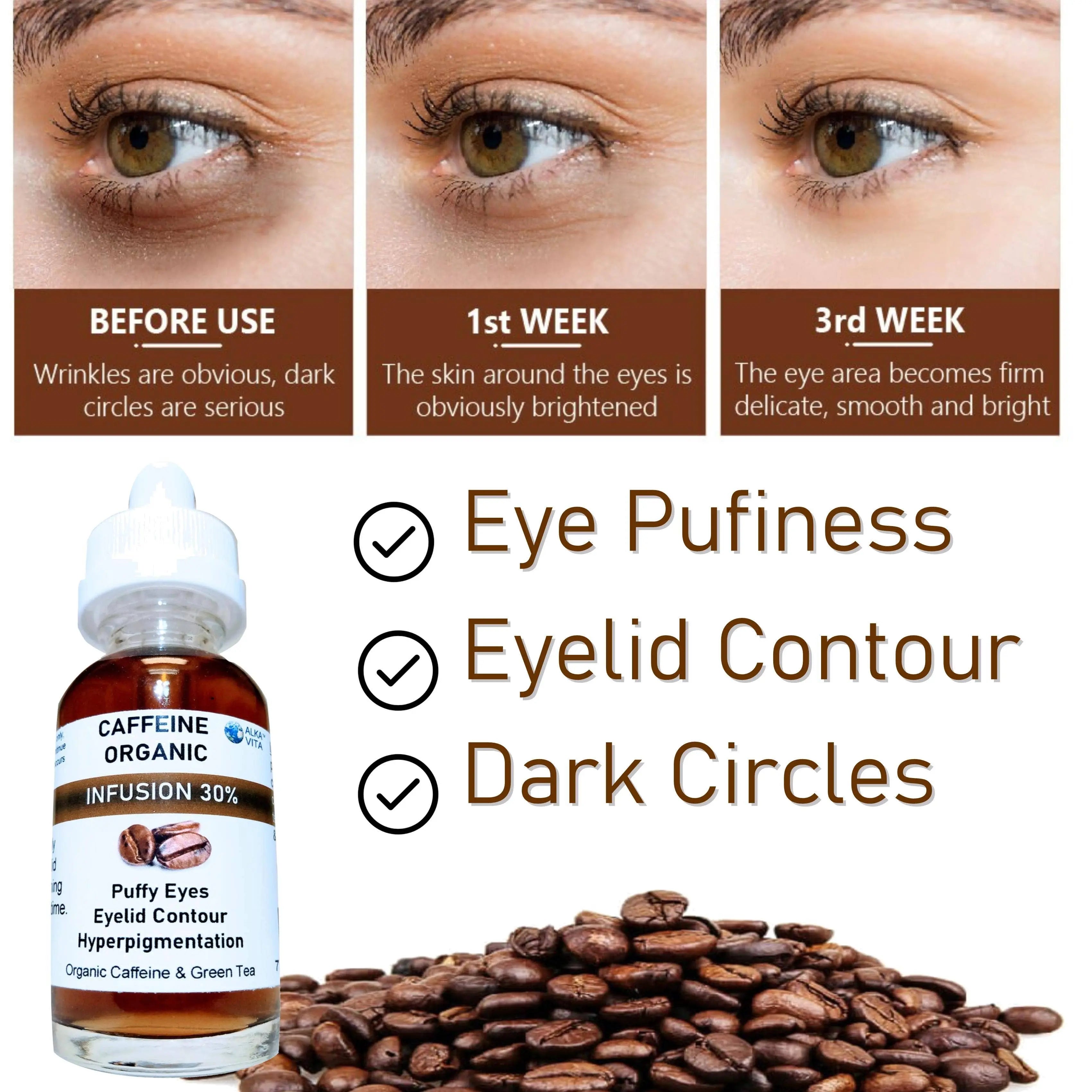Puffy Eyes Caffeine 30% Infusion The Highest Concentration