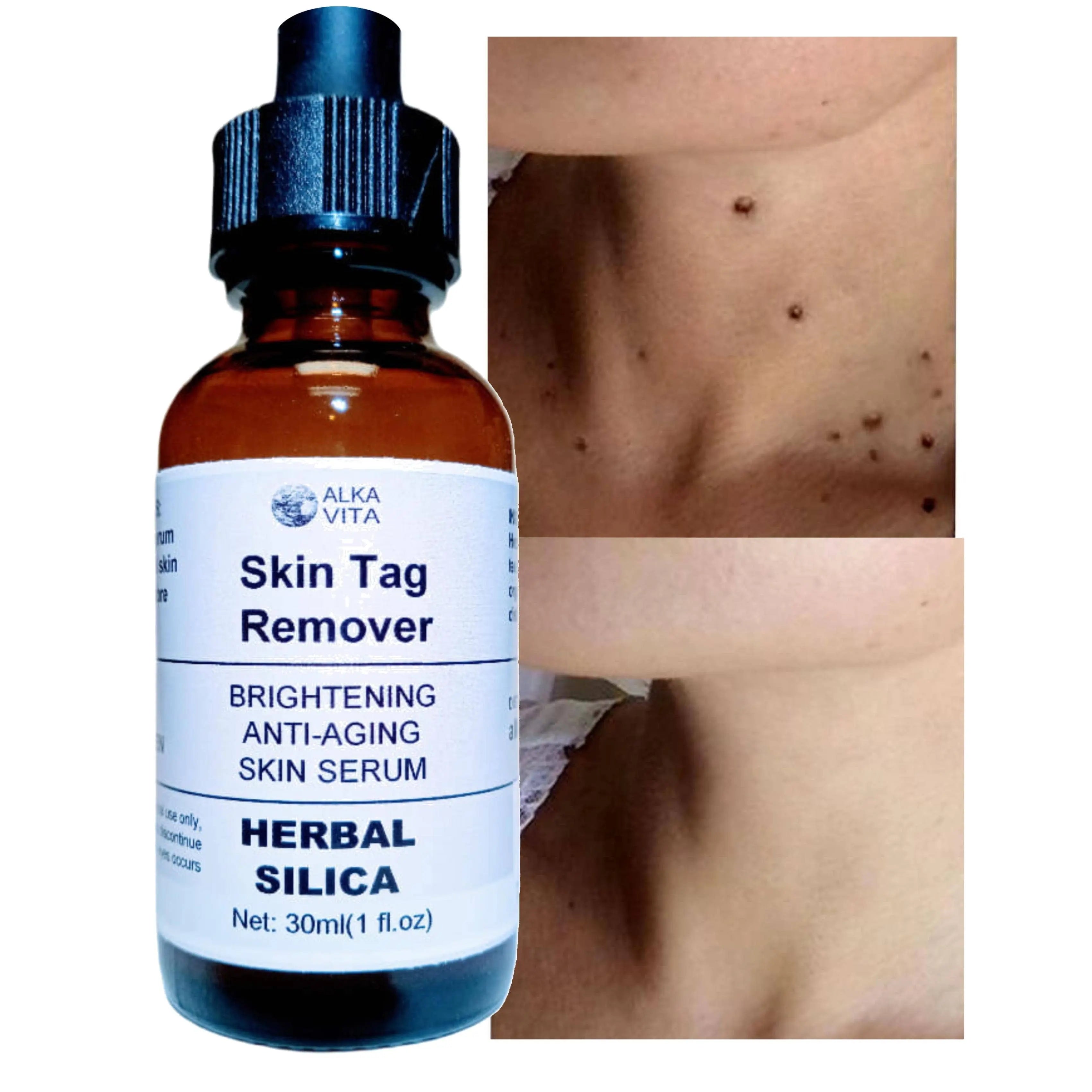 Skin Brightening Anti-aging Herbal Silica Facial Serum