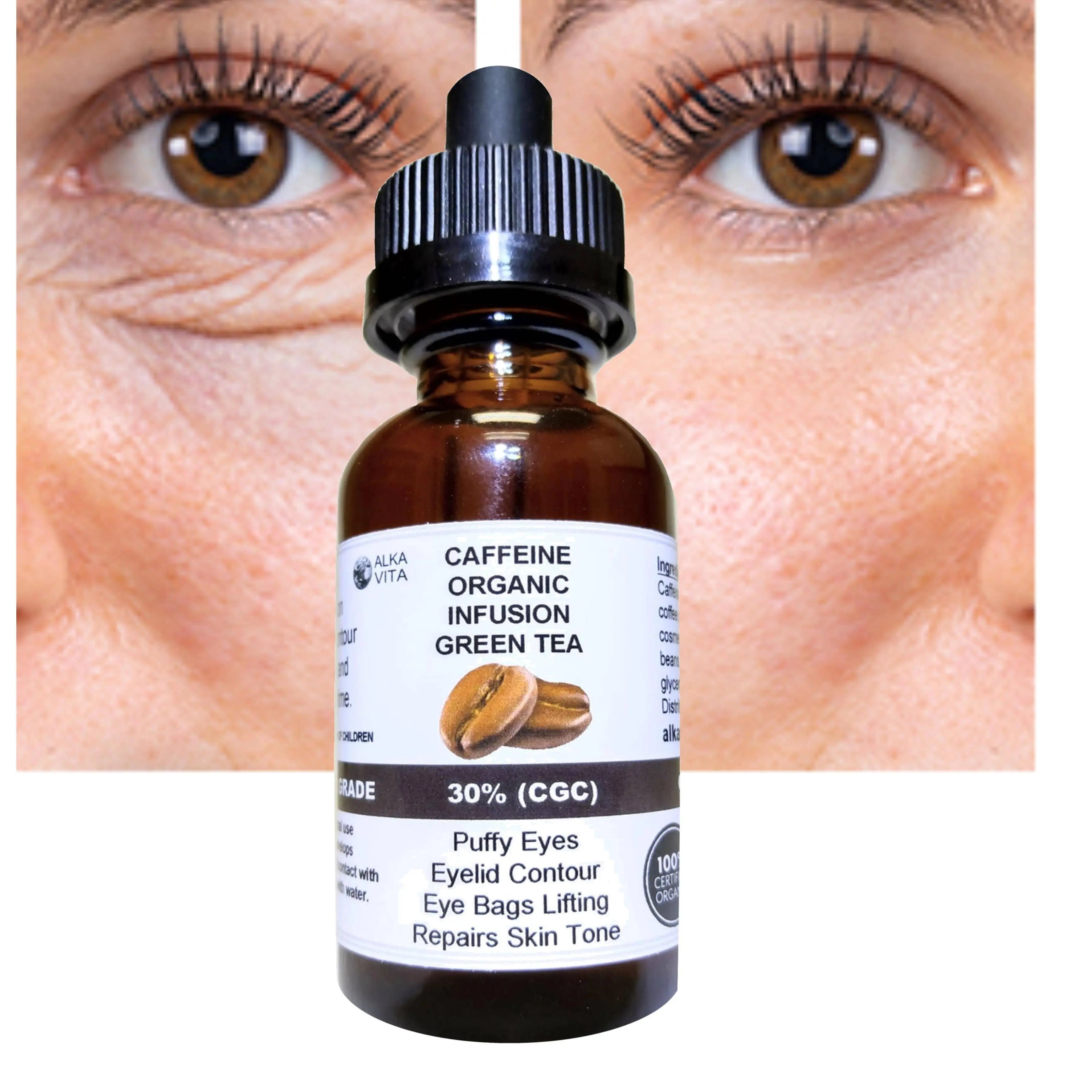 Puffy Eyes Caffeine 30% Infusion The Highest Concentration